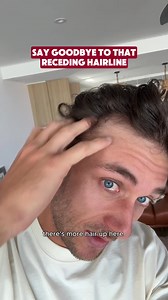 Jack Steele has been using Bouf for six weeks now and the results speak for themselves! Say goodbye to those patches and hello to thick, healthy and long hair with Bouf. | Bouf Haircare