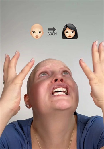 Wie findet ihr meine neue Perücke?😍👩🏻 cr: @lou | beauty & lifestyle #alopecia #perücke #wig #nohair #makeup