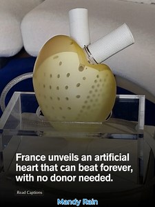 France’s Carmat artificial heart, made with biocompatible materials and aerospace-grade sensors, mimics the natural rhythm of a real heart and adjusts in real time to the body’s needs. Powered by external batteries, it allows patients freedom from hospital hookups and transplant waitlists. Early trials show it can sustain life for months to years, offering new hope for end-stage heart failure patients. | Mandy Rain