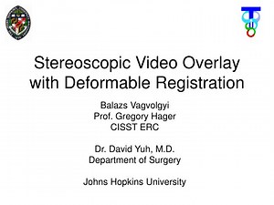 Stereoscopic Video Overlay with Deformable Registration - SlideServe
