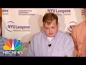 Face Transplant Recipient: 'My Life Has Changed And Been Renewed' | NBC News