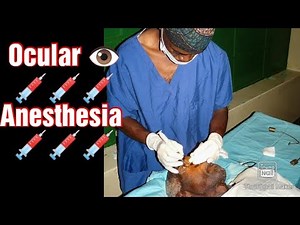 Ocular 👁️ Anesthesia || Types of ocular anesthesia 👁️||