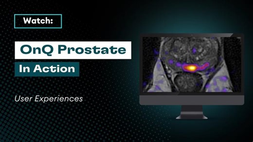 OnQ Prostate in Action: User Experiences | Rebecca Johnson
