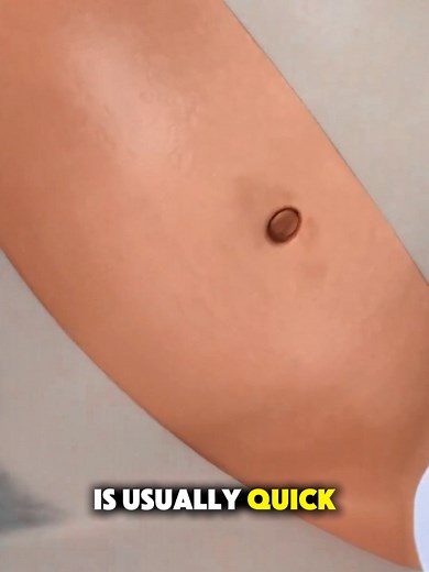 How Tubal Ligation is Done? (3D Animation) #how #tuballigation #surgical #life #3danimation