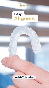 Do you have questions about our Direct Aligners? In this video, Doc Sly answers the most common questions — from how they’re made to how fast you can get them and why they’re a great option for straighter teeth. Watch now and get to know why our aligners are a game-changer for your smile! FOR INQUIRIES & APPOINTMENTS: 📍 Visit us: Unit 1621, 16th Floor, Centuria Medical Makati (Walk-ins welcome!) 📞 Call or text us: (02) 8570-9619 | 0917-876-8963 | 0917-108-1528 💻 Online consultations available