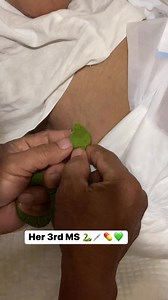 Her 3rd MS 🐍💉💊💚 Maka agay na 😁 Bisan pa ug gepagawas na sa Hospital Kay wala nay ihatag nga tambal, kinsa man ta para did-an siya sa MS? GINOO ray nkabalo sa atong kinabuhe 🙏 Habang may buhay may pag Asa 🙏 Mao gani nga samtang di pa kaau ta grabe gebati, pag di lang mahadlok papaak na. Prevention is way better than cure 💪 GOD bless you Unte 🙏 Right to Indigenous Knowledge Systems and to Develop own Sciences and Technologies. REPUBLIC ACT NO. 8371, IPRA LAW, 1997, Sec 34. Our Family’s Na