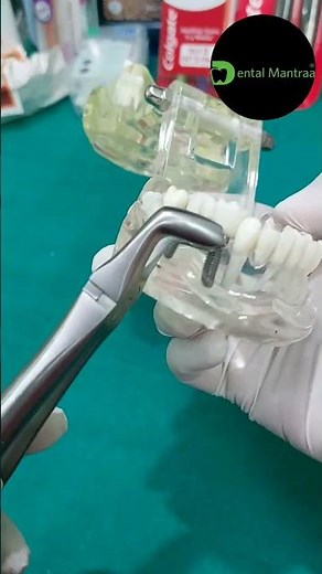 Dental Extraction Forceps Explained!”“Complete Guide: Extraction Forceps”“Dental Tool