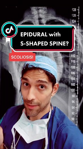 Epidural for Scoliosis: What You Need to Know