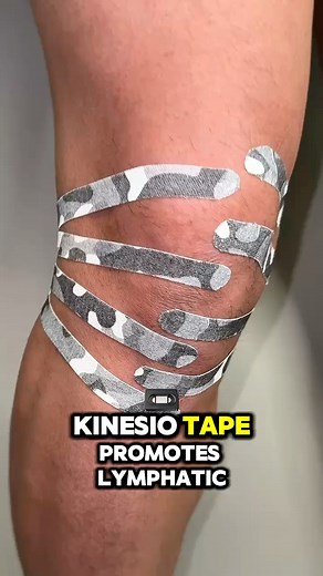 Kinesiotape promotes lymphatic… #kinetape #knee #lymphaticdrainage | Kinetape Academy