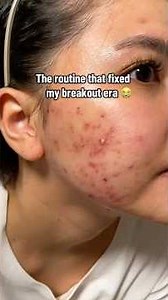 Skincare routine for those who asked 🫶🏻