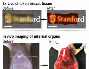 Yellow food dye could give doctors a new way to look beneath the skin