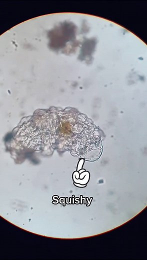 Adorable Tardigrade Interaction Under Microscope | Cute Moss Piglet Video