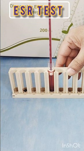Esr westergren method | ESR test means | What does ESR lab test show?#laboratory #test #bloodtest