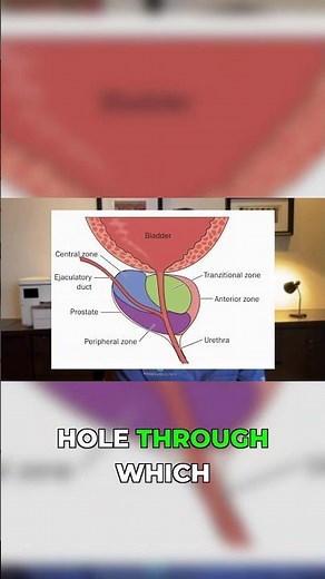 Donut-Shaped Prostate: Understanding BPH