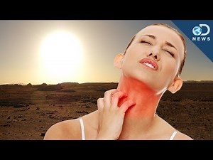Top 5 Strangest Allergies