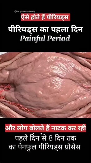 Arti Parihar on Instagram: "औरत कभी नाटक नहीं करती बस उन्हें समझना पड़ता है || #babycaremadeeasy #instagram . . #pain #womenfact #fact #painfull #drama #life #lifestyle #months #periods #painfullperiods #reelindia #reelinstagram #reelitfeelit #motherhood #reel #reelinsta #reels #babycare #forbaby #womenlife #toughlife #tough #day #daybyday #eyeopner"