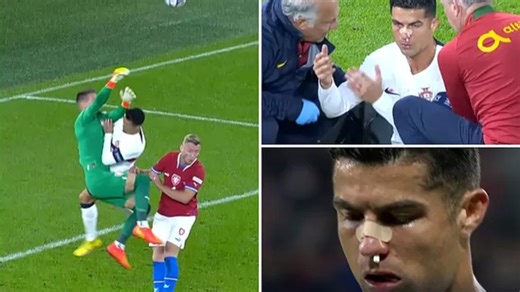 The blow that gave Cristiano Ronaldo a bloody nose