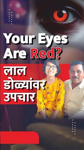 How To Get Rid Of Red Eyes | Red Eyes Treatment