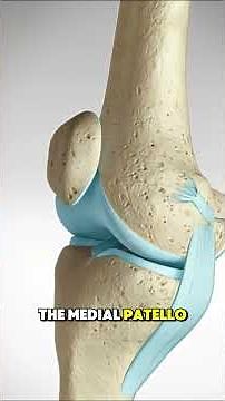 Patella Dislocation Surgery 3D Animation#patelladislocation #kneesurgery #orthopedicsurgery #medical