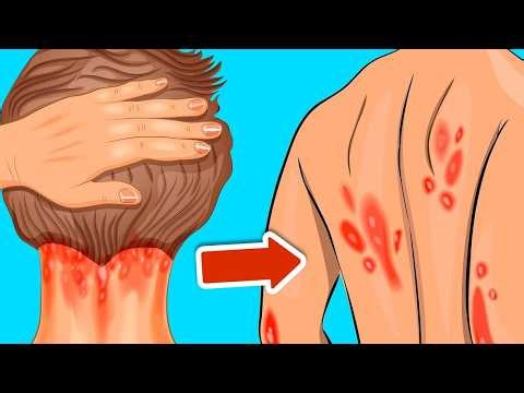 10 Warning Signs You May Be Low on Vitamin D