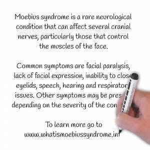 273 reactions · 327 shares | What is Moebius Syndrome? #MSAD #moebiussyndrome #raredisease | Many Faces of Moebius Syndrome | Facebook
