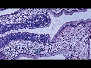 Anatomy and Physiology I Lesson 2: Tissue Level of Organization