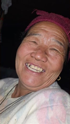 Golden Teeth, Golden Heart 💛 | A Moment in the Mountains