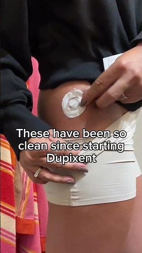 7+3 week subcutaneous Remodulin site pull (#pulmonaryarterialhypertension treatment)