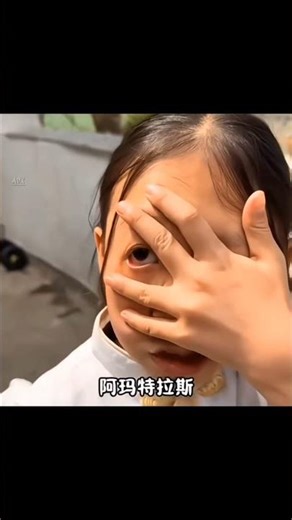 Amaterasu 🔥 Itachi Uchiha Edit | Don’t Blink 🩸” #shorts #trending #viral