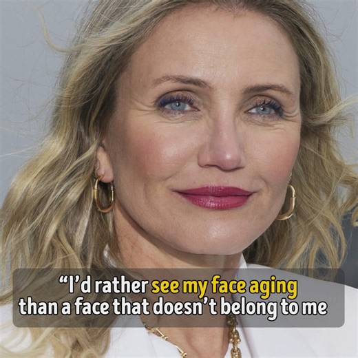 From Cameron Diaz regretting Botox and embracing her natural glow to Sadie Sink proudly keeping her look untouched, Hollywood’s biggest names are rewriting the rules on aging. No filters, no apologies, just confidence, wisdom, and unfiltered honesty. Remember Kate Winslet calling confidence the real secret to beauty? Or Jamie Lee Curtis slamming the term "anti-aging" as unnatural? Then there’s Diane von Fürstenberg, who sees wrinkles as "the map of your life," and Jane Fonda, who insists passion