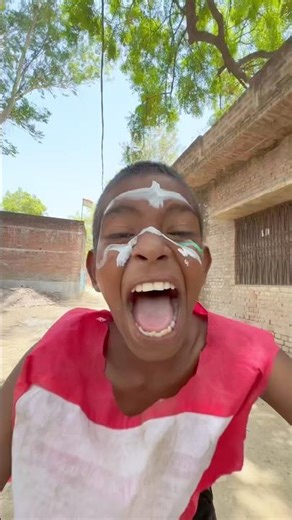 Cycle accident aur Chita Bhai😂￼ #trendingshorts #viralshort #youtubeshorts #comedyshorts #funny #sh