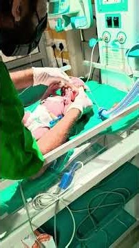 How to Insert OG Tube in Newborn |Orogastric Tube Feeding Procedure (NICU)#NICU #OGtube #NewbornCare