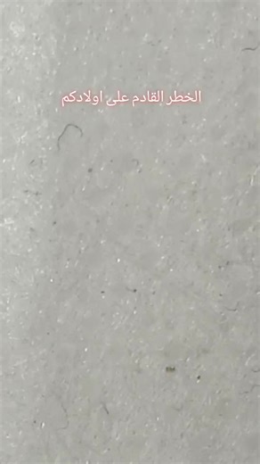 Insect Movement on Textured Surface Close-Up