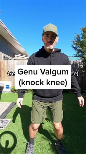 Effective Solutions for Genu Valgum (Knock Knee)