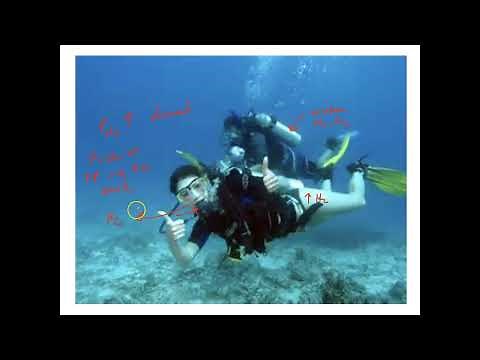 Unit 3, Part 14 Decompression Sickness