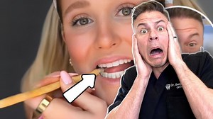 Ever wondered if those perfect teeth are actually real? Here's how to tell #DentalHygienistWeek #OralCancerAwarenessMonth #TeethTransformation #DentistHumor | TheBentistofficial