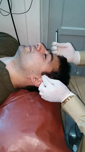 Demo-2: Supraorbital and temporal block before PRP