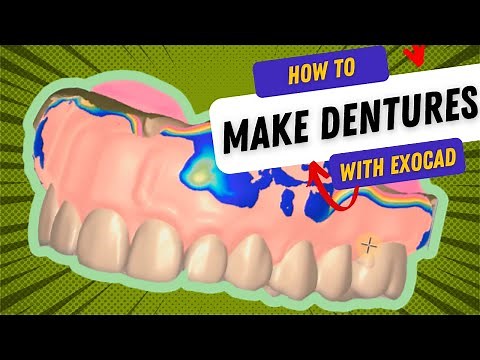 Full Denture Design Using Exocad - Step by Step Walkthrough Tutorial