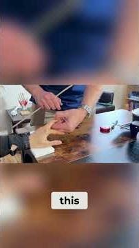 Snapping Tendon vs Trigger Finger: What You NEED to Know #snappingtendon #triggerfinger