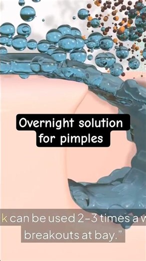 Get Rid of Pimples In 1 Day Powerful Homemade Face pack