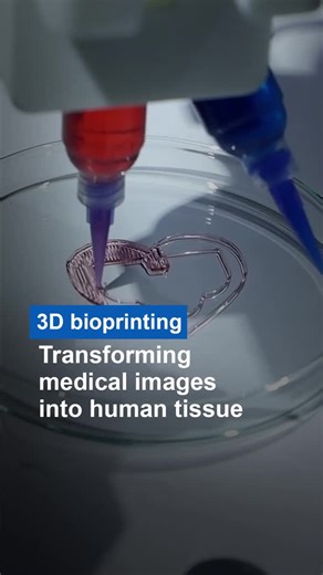 Could a machine bioprint a humanlike organ? Mayo Clinic regenerative biotherapeutics researchers are studying ways to harness the potential of the emerging field of bioprinting tissue. Learn more: https://mayocl.in/4aB959D | Mayo Clinic