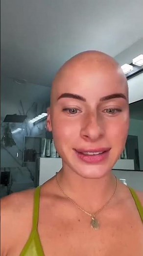 THE SILENCE AT THE END😂😭 #comedy #funny #bald #baldgirl #shavedhead #alopecia #viral #trending
