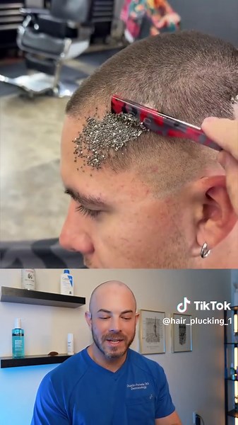 Doctor Analyzes Scalp Ticks and Skincare Tips