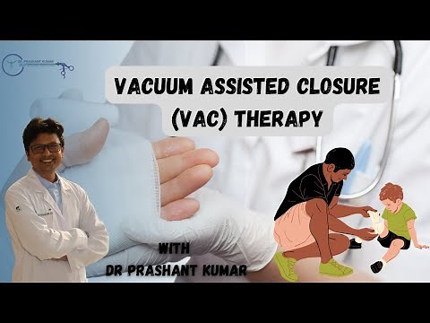 Vacuum assisted closure (VAC) Therapy