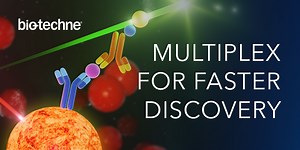 Optimizing Cytokine Analysis-Choosing the Right Assay for Accurate Detection and Interpretation of Cytokine Expression