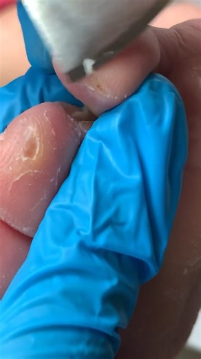 Foot scraping dead skin #pedicure | Nail Salon