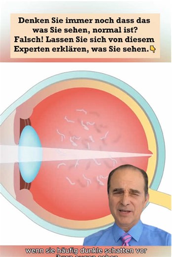 Glaubst du immer noch, dass es für deine Augen normal ist, eine solche Szene zu sehen? Falsch 🙅, dieses Video wird diese Szene für dich beantworten.#tik_tok #fyp #aihost #auge #foruyou