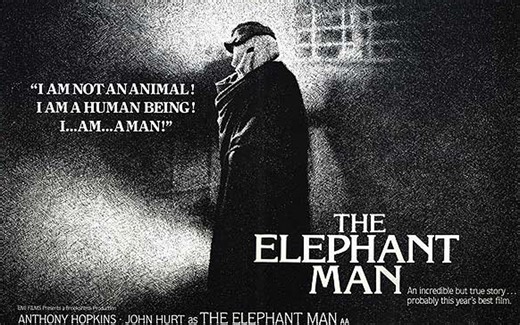 英语 | 象人'The Elephant Man' 滚动字幕中英对照 (双语读物) 【有声书】Tim Vicary