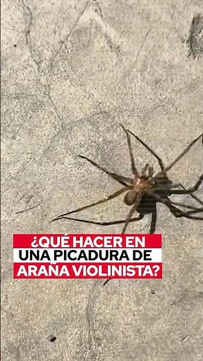Cómo sobrevivir a la picadura de una araña violinista