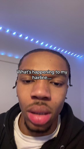 What’s Happening to My Hairline? #JesseRejame #TMCJesse